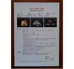 醫(yī)用B超/放射膠片—醫(yī)用激光膠片